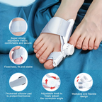 Limited Time: 30% OFF⚡ Adjustable Bunion Corrector & Toe Separator Kit